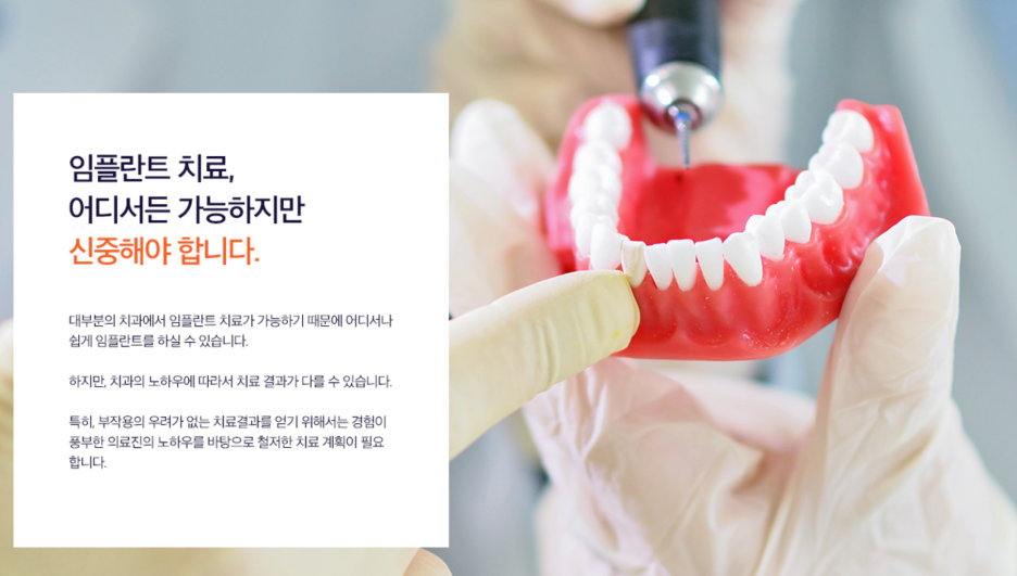 임플란트 치료에 대한 신중한 접근을 강조하는 문구와 치아 모형 사진