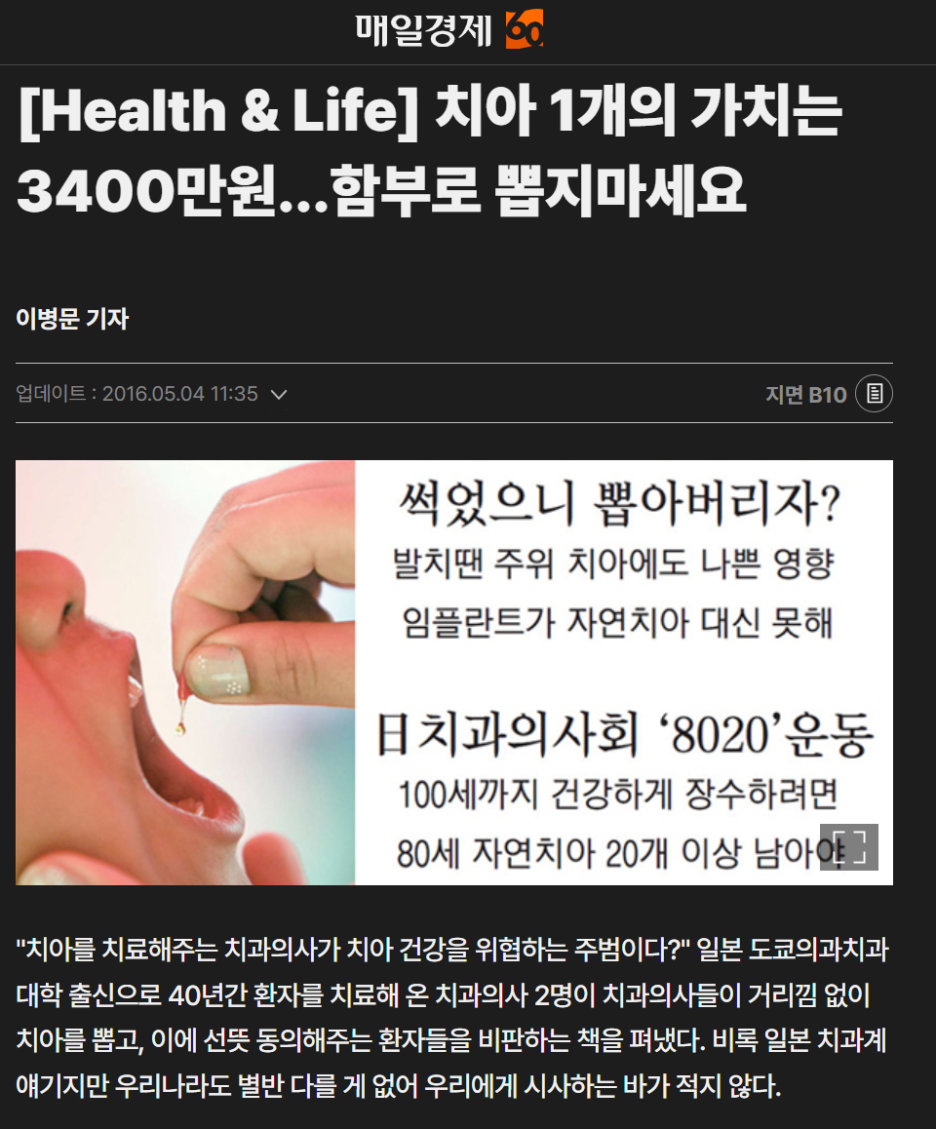 매일경제 신문 기사 '치아 1개의 가치는 3400만원...함부로 뽑지마세요'