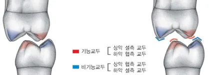 치아 교두의 기능적 분류를 설명하는 치과용 일러스트