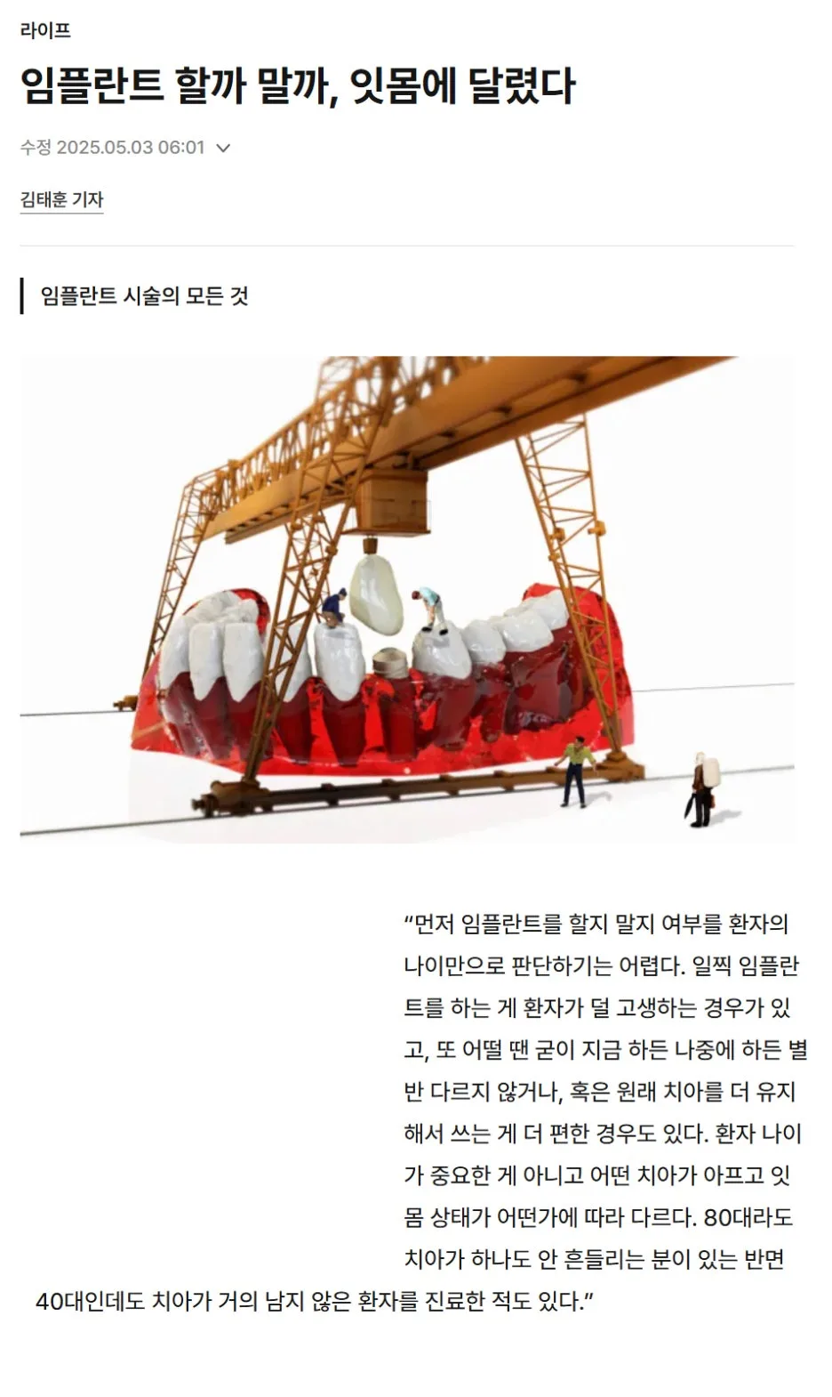 임플란트 시술 결정에 대한 기사 제목과 본문 일부